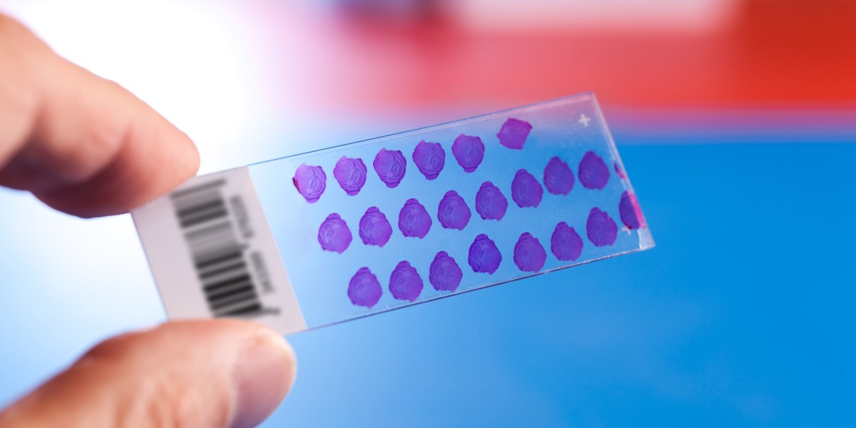 Global Tissue Microarray Market Share to Register a Phenomenal CAGR between 2022-2030; Declares MRFR