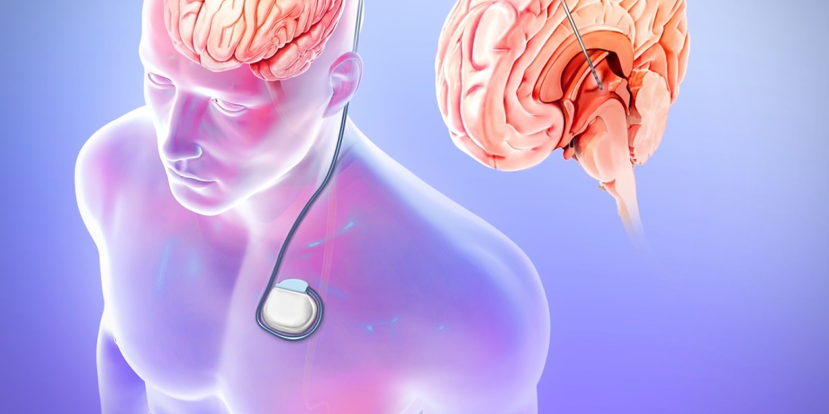 Global Epilepsy Surgery Market Share Mostly to be Led by North America During Review Period (2023-2032)