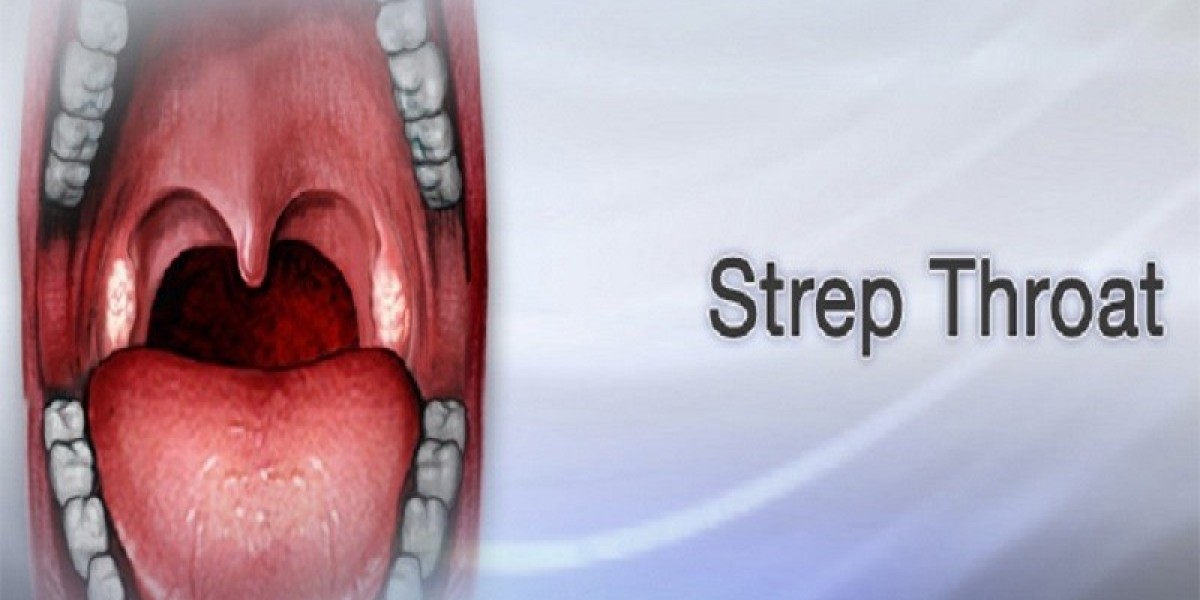 A Comprehensive Guide to Strep Throat Without Tonsils