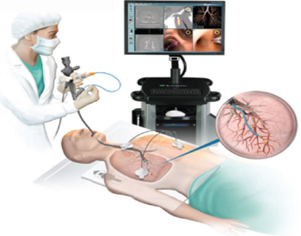 Best Video Bronchoscopy Doctor in Whitefield Bangalore | Bronchoscopy specialist in Manipal hospital Whitefield.