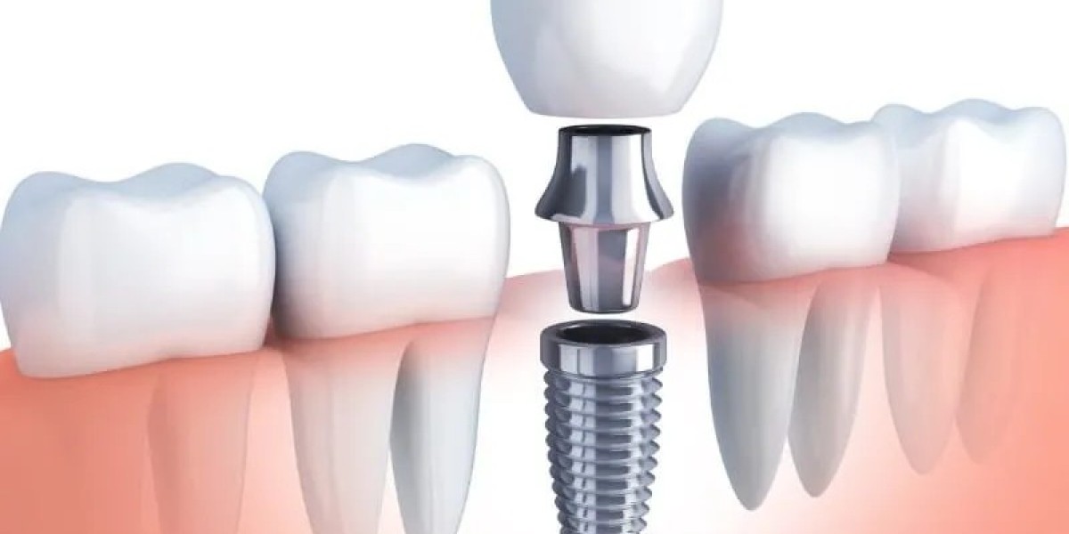 Cosmetic Dentistry: Transforming Smiles and Boosting Confidence